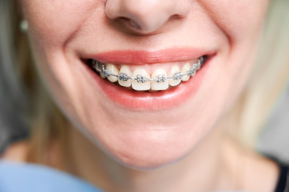 Sandwich Orthodontic Services
